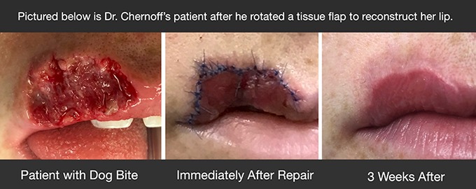 reconstructive-plastic-surgery-a