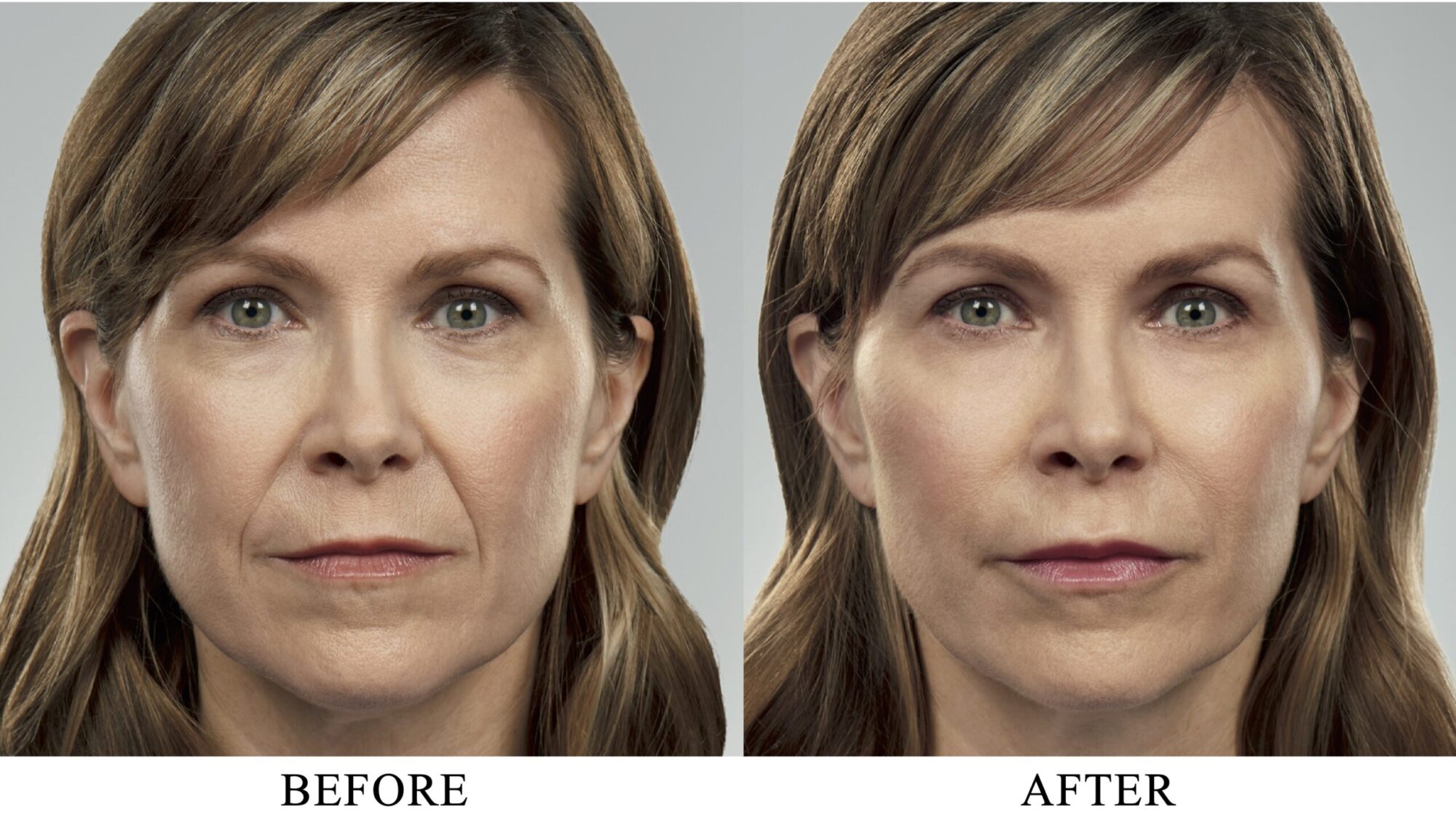 Voluma_Woman-scaled