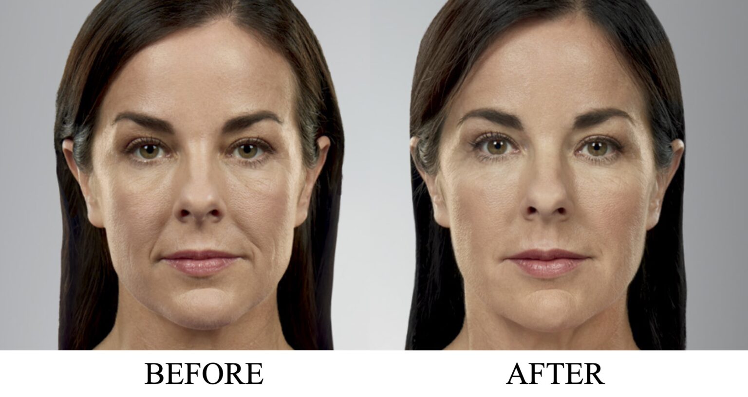 Chernoff Cosmetic Indianapolis