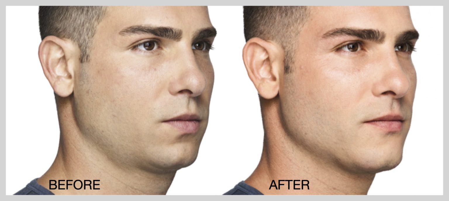 Chernoff Cosmetic Indianapolis