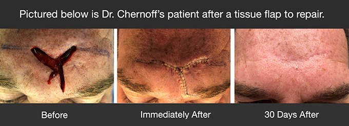 Chernoff Cosmetic Indianapolis