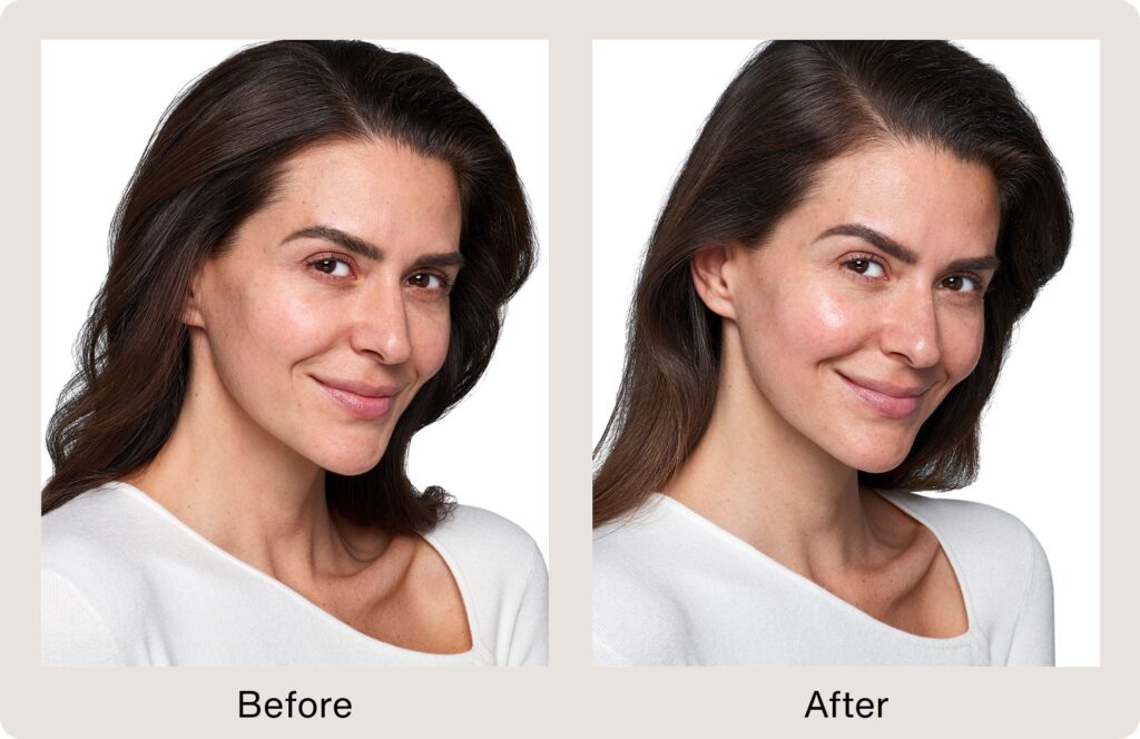 SkinVive1