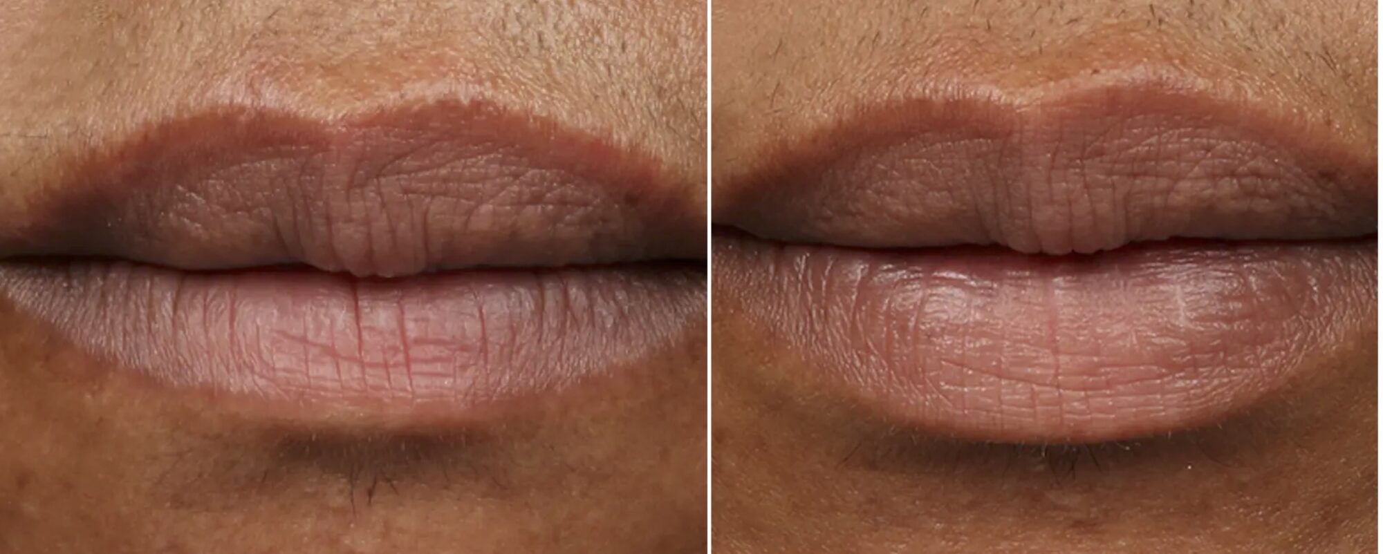 Our_Self_Lips_Chernoff_2-scaled