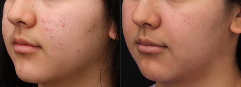 close-up of skincare regimen supporting wrinkle treatment Indianapolis